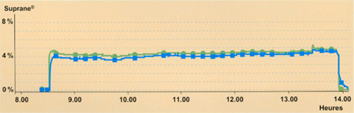 Fig21.jpg (82755 octets)