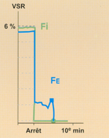 Fig23.jpg (31835 octets)